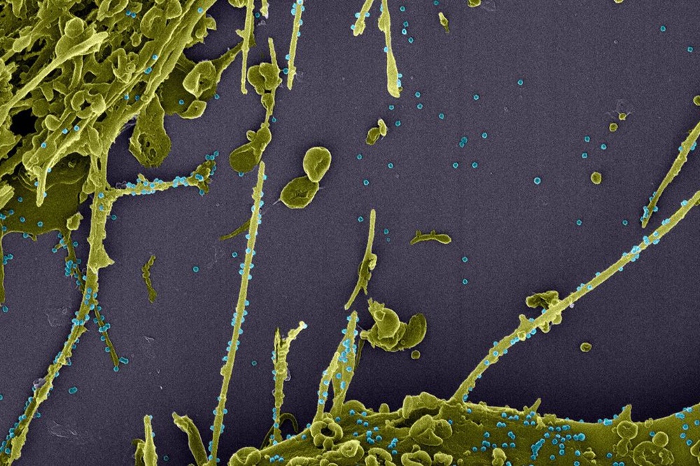 Anticorpos contra covid-19 duram pelo menos sete meses, mostra estudo